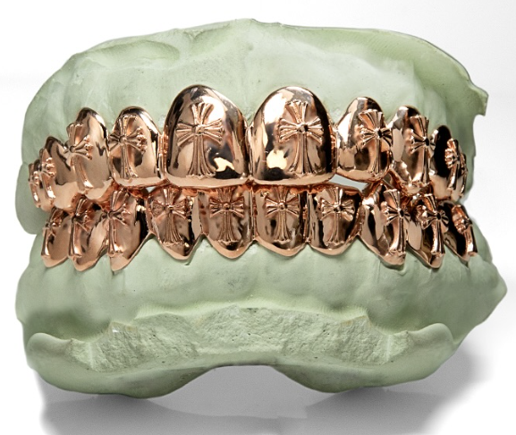 Custom Gold Grillz